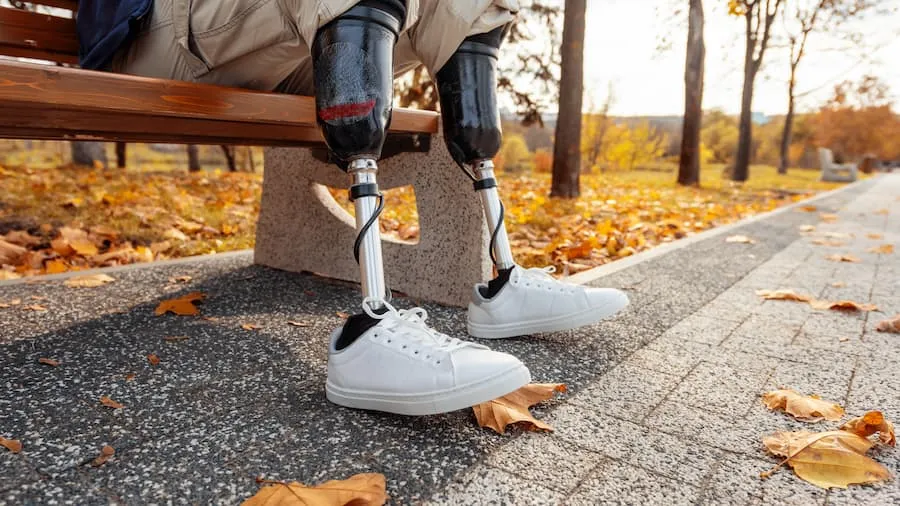 How Local Prosthetic Care Can Help Patients Searching for Prosthetics Near Me
