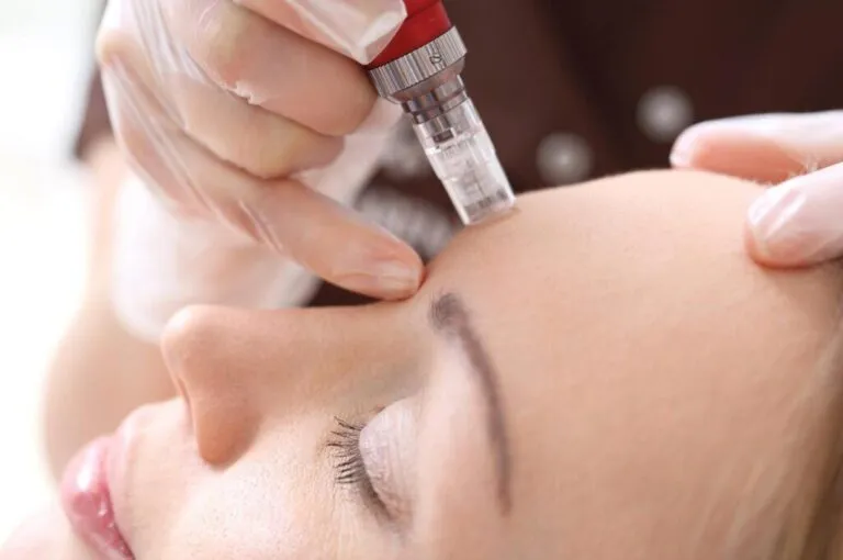 Refreshing Tired-Looking Skin with Mesotherapy Treatment in London