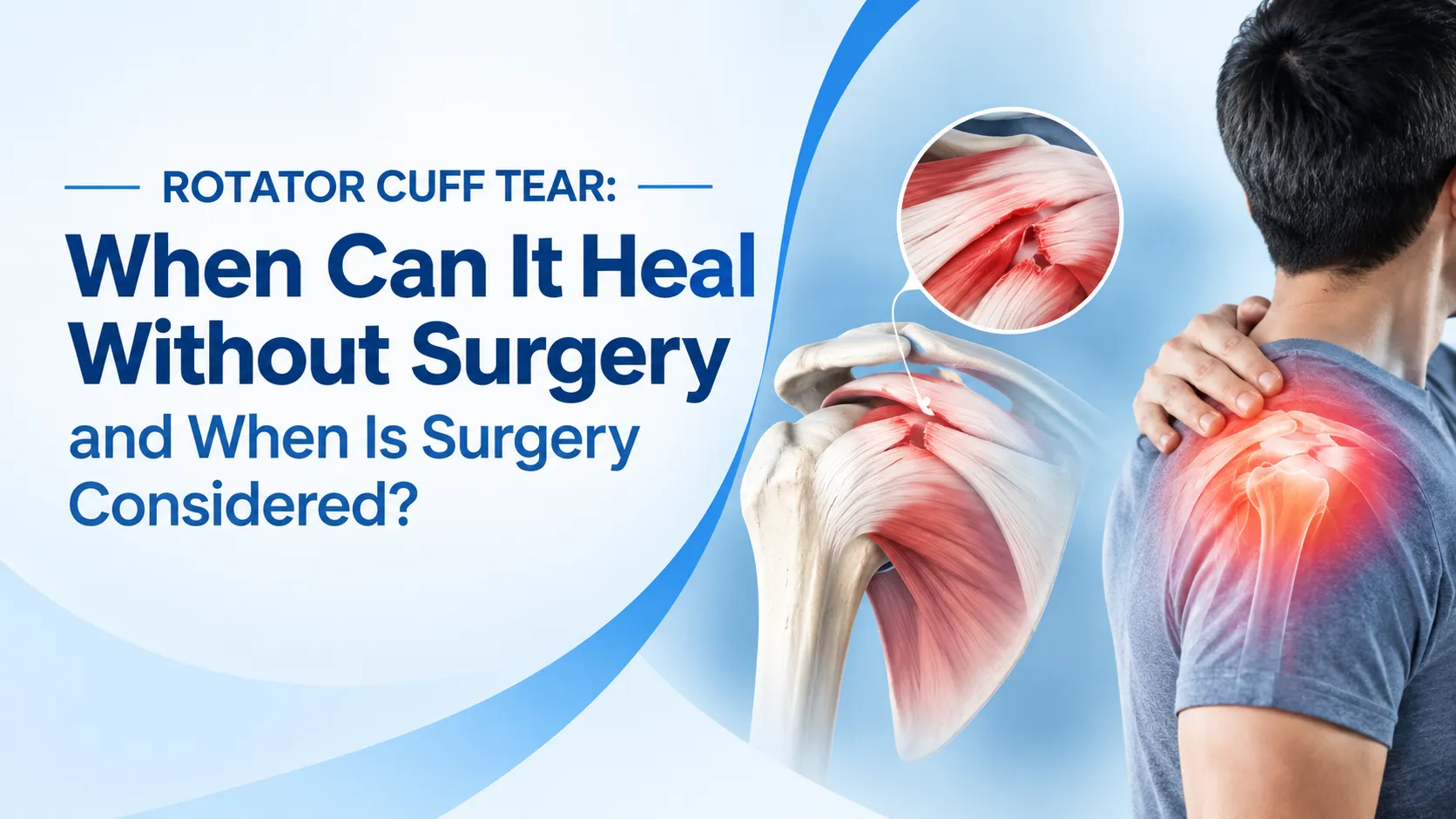Rotator Cuff Tear: When Can It Heal Without Surgery and When Is Surgery Considered?