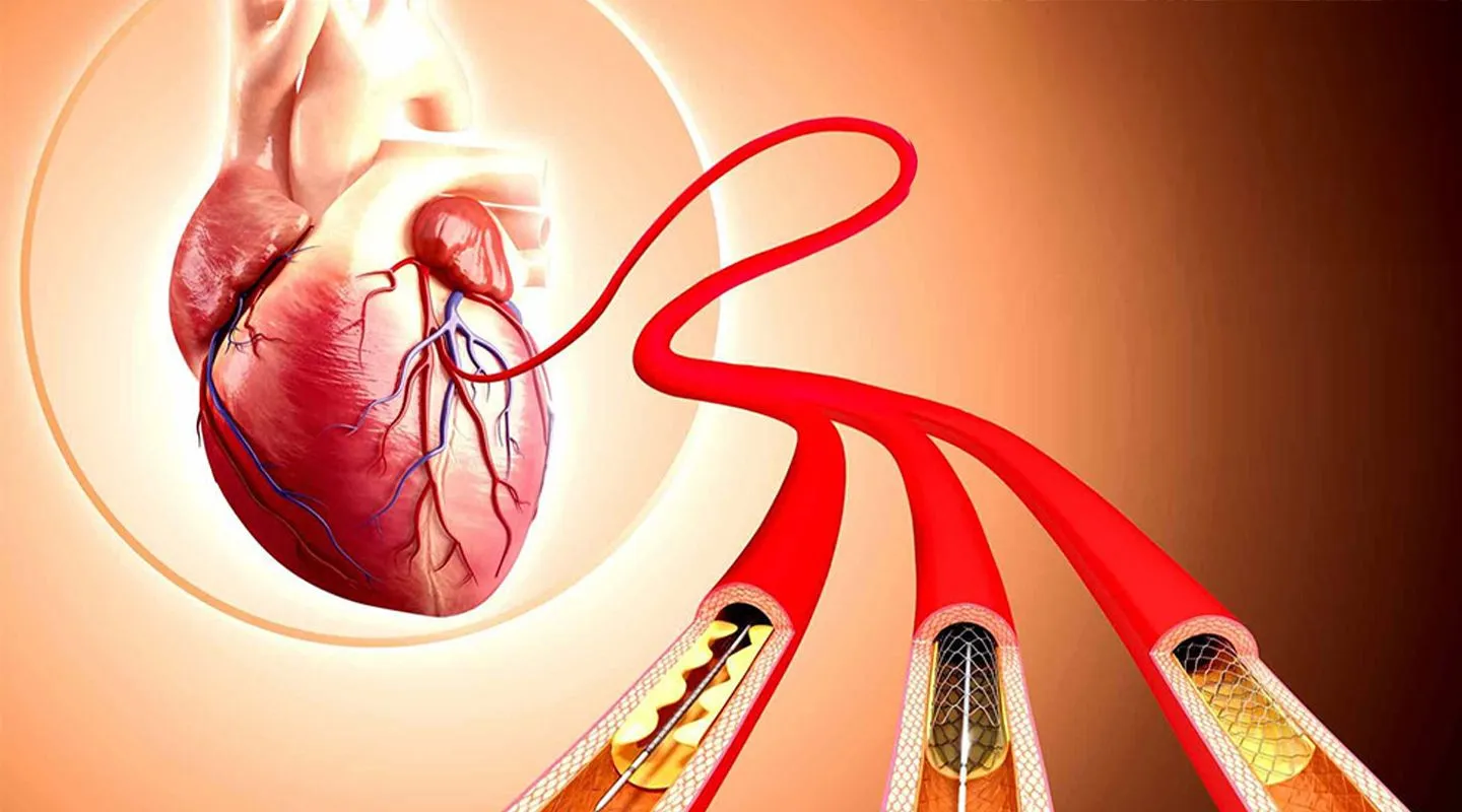 Hospital for Heart Surgery: Understanding Cardiac Care at Kare Partners Heart Centre