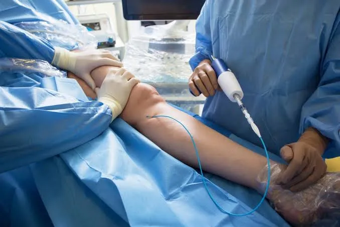 Common Conditions Managed Through Vascular and Endovascular Procedures