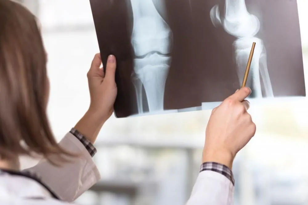 Bone Health after 30's