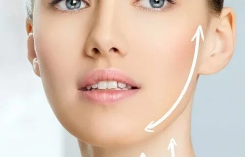 PERMANENT TREATMENT OF WRINKLES AROUND THE EYES