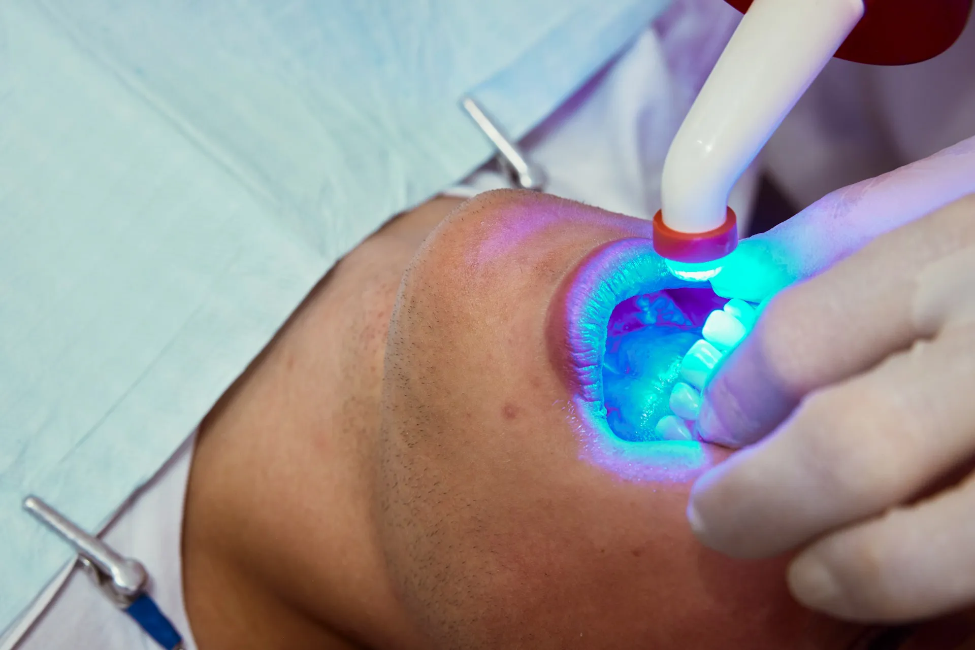 A Brighter Smile Starts With Professional Boutique Whitening