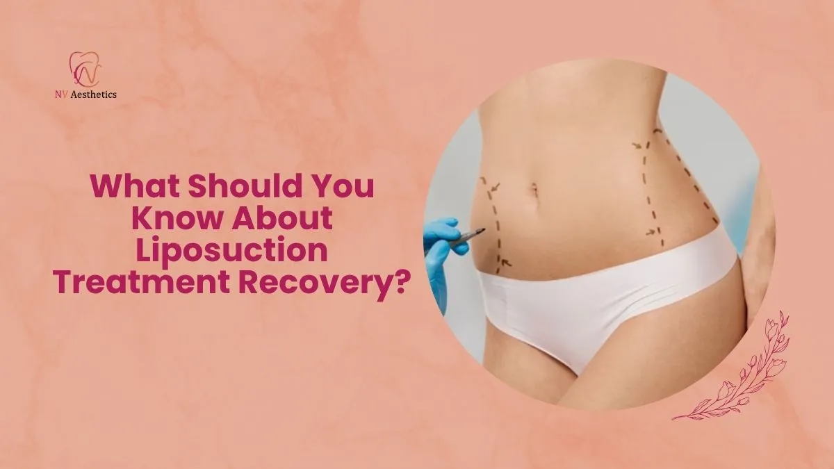 What Should You Know About Liposuction Treatment Recovery?