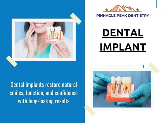 What Patients Should Know Before Dental Implants Treatment in Scottsdale