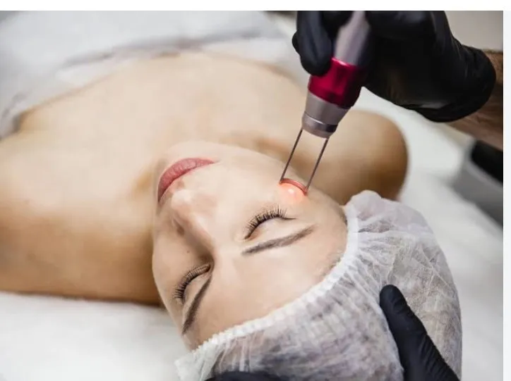Picosecond Laser Side Effects: Common Reactions and Precautions to Know Before Treatment