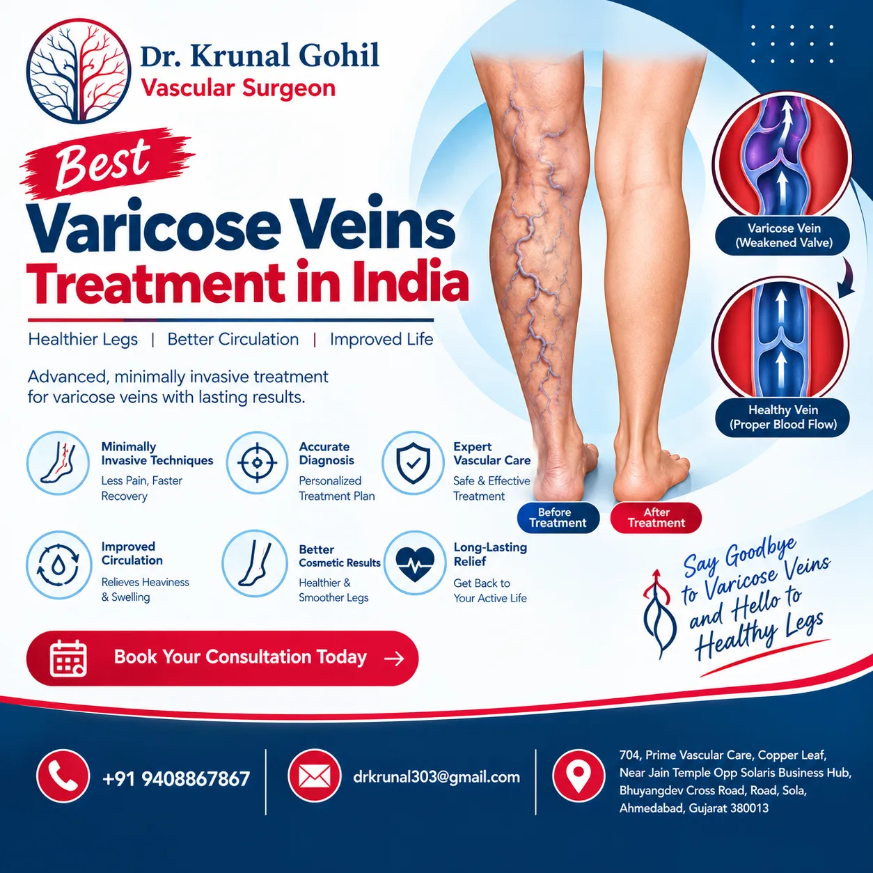 Can Varicose Veins Cause Swelling and Leg Discomfort?
