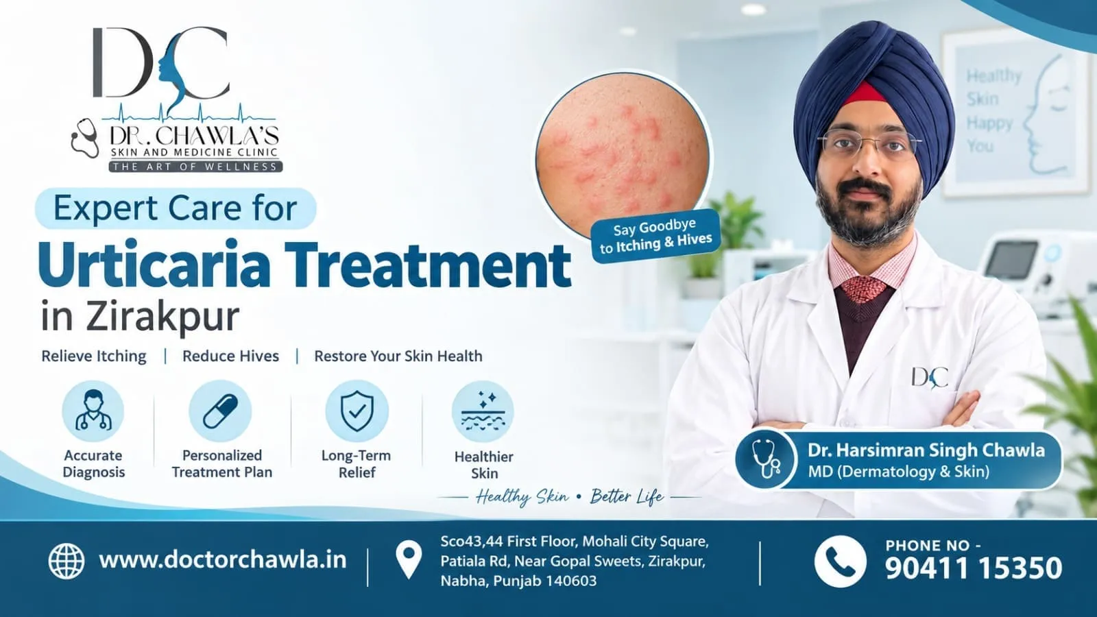 Urticaria Treatment in Zirakpur: Causes, Symptoms and Treatment Options