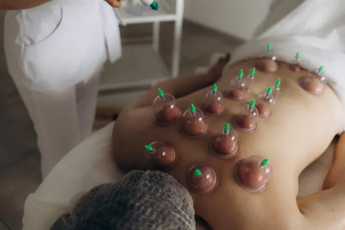 7 Benefits of Cupping Therapy for Your Body and Mind