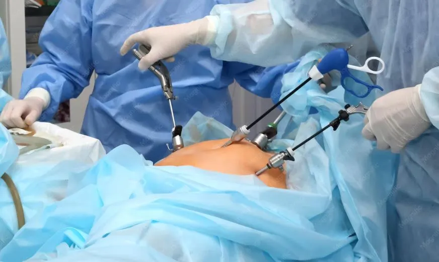 Laparoscopic Hernia Repair: What Patients Need to Know