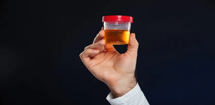 Urine Routine Test Vs Urine Culture Test – Difference and Purpose