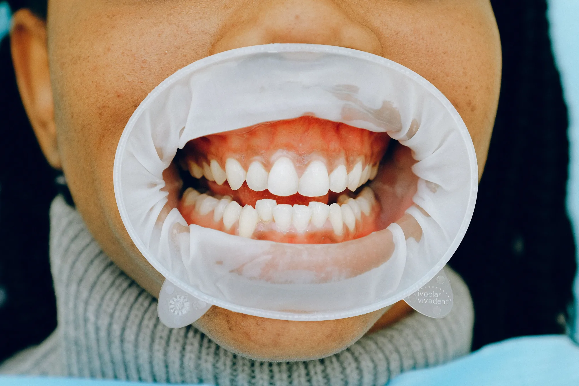 How to Keep Your Smile Healthy Without Breaking the Bank