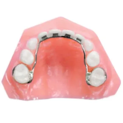 Supporting Pediatric Smiles Through Specialized Groper Appliance Lab Services