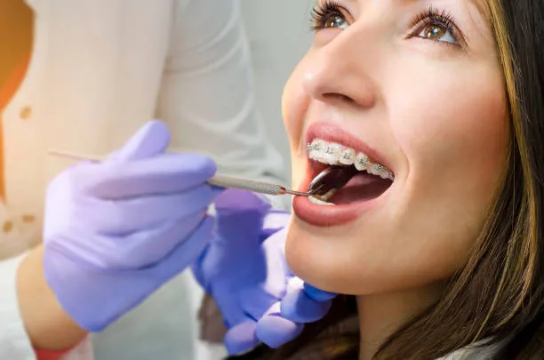 How much do braces cost in San Antonio, TX?