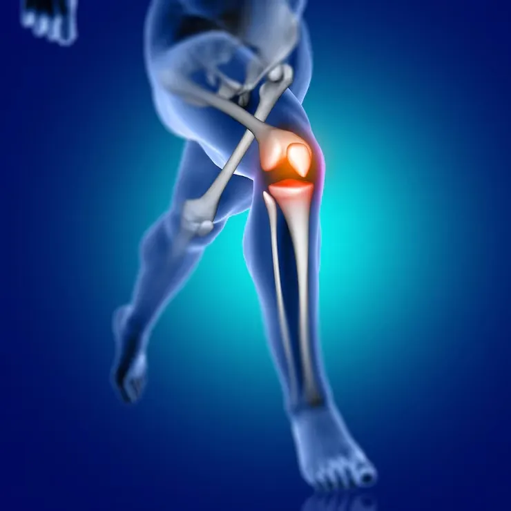 Topical Analgesic for Joint Pain and Movement Support