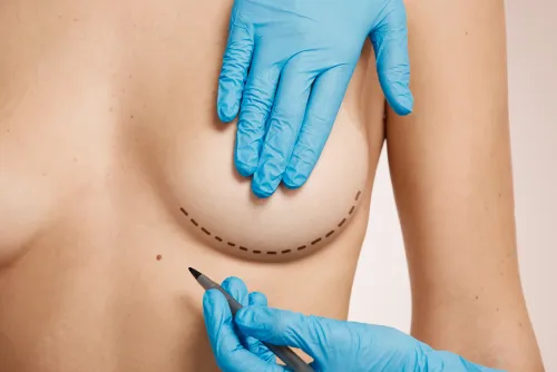 Will Breast Reconstruction Leave Scars? What Patients Should Know