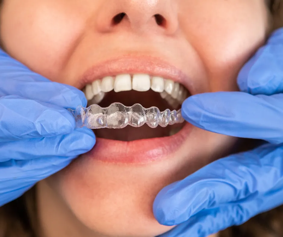 How Can Implant Dentistry in Cranbourne Help Restore Missing Teeth and Your Smile?