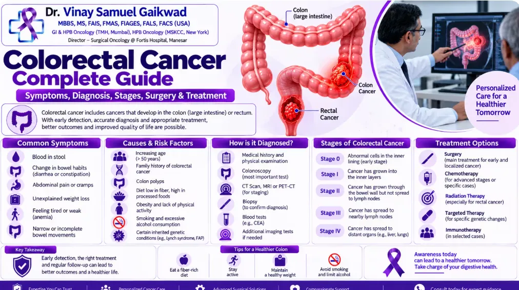 Colorectal Cancer Complete Guide: Symptoms, Diagnosis, Stages, Surgery & Treatment