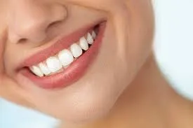 How Professional Tooth Whitening Treatment Can Brighten Your Smile