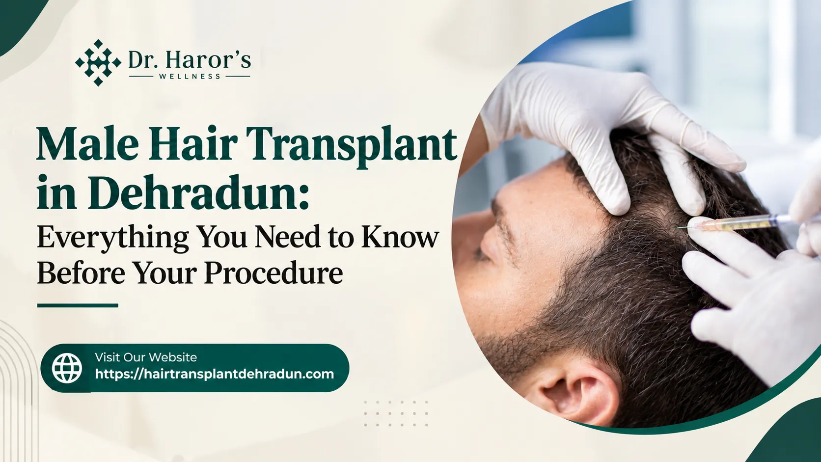 Male Hair Transplant in Dehradun: Everything You Need to Know Before Your Procedure