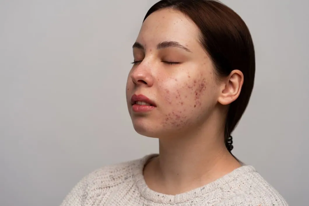 Understanding How Skin Pigmentation Bristol Can Improve Uneven Skin Tone
