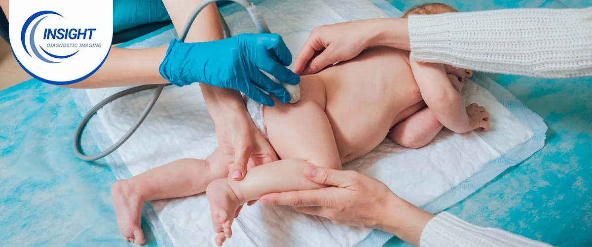 Why Timing Matters for a Baby's Hip Ultrasound