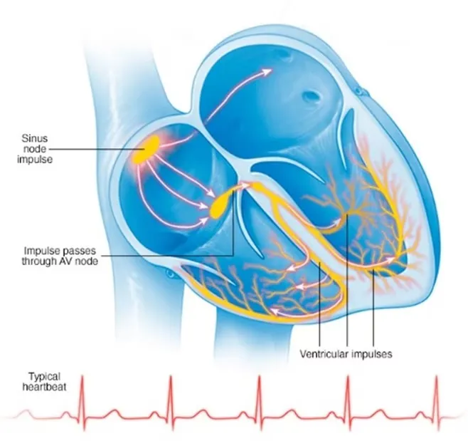 How Can Heart Ablation Help Manage Frequent PVCs?