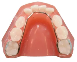Supporting Growing Smiles With Modern pediatric orthodontic appliances