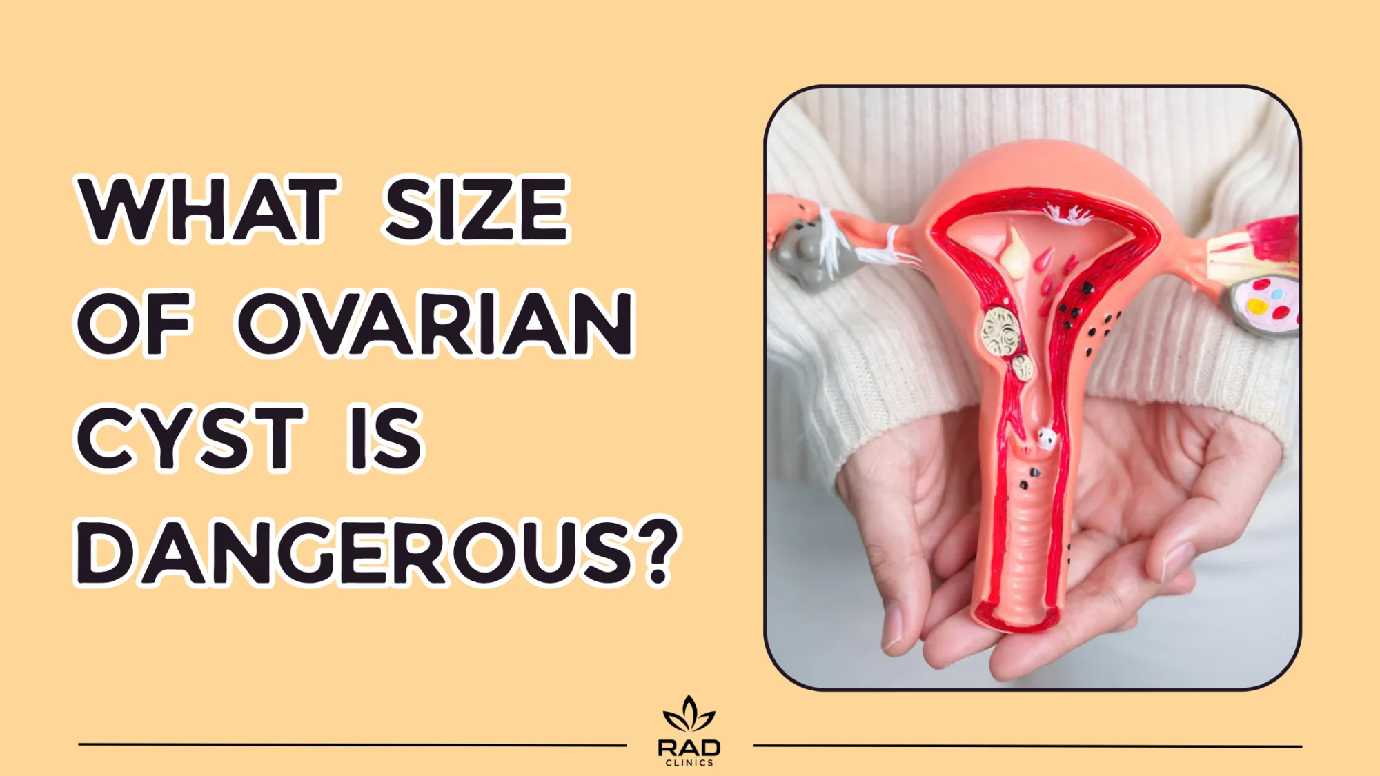What Size of Ovarian Cyst Is Dangerous?