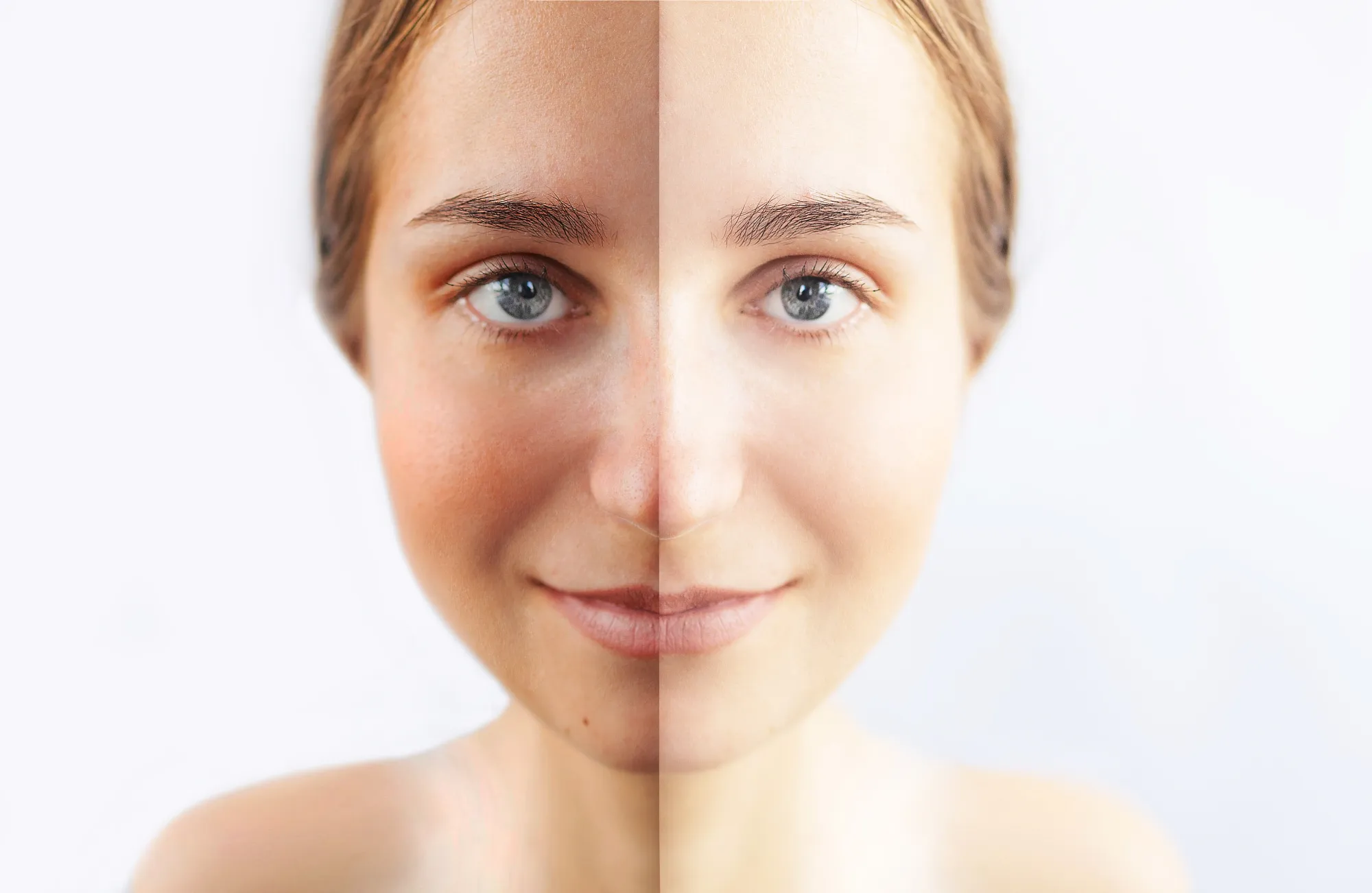 7 Myths About Skin Whitening Treatment That Need Correcting