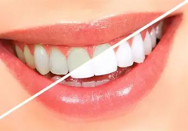 A Smile for Every Occasion: Everyday Dental Care That Makes a Difference