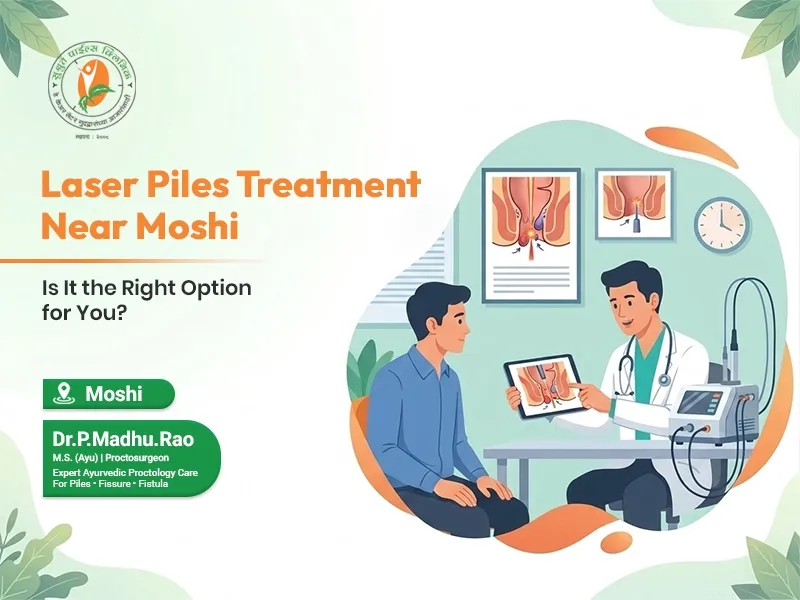 Thinking About Laser Piles Treatment Near Moshi? Questions to Ask First