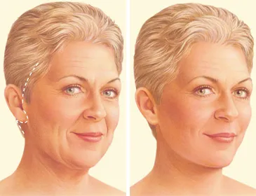 Best Aesthetic Clinic Abu Dhabi: When Good Aesthetics Means Knowing When to Stop