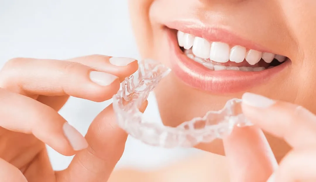 Finding a Reliable Clear Aligner Lab for Dentists