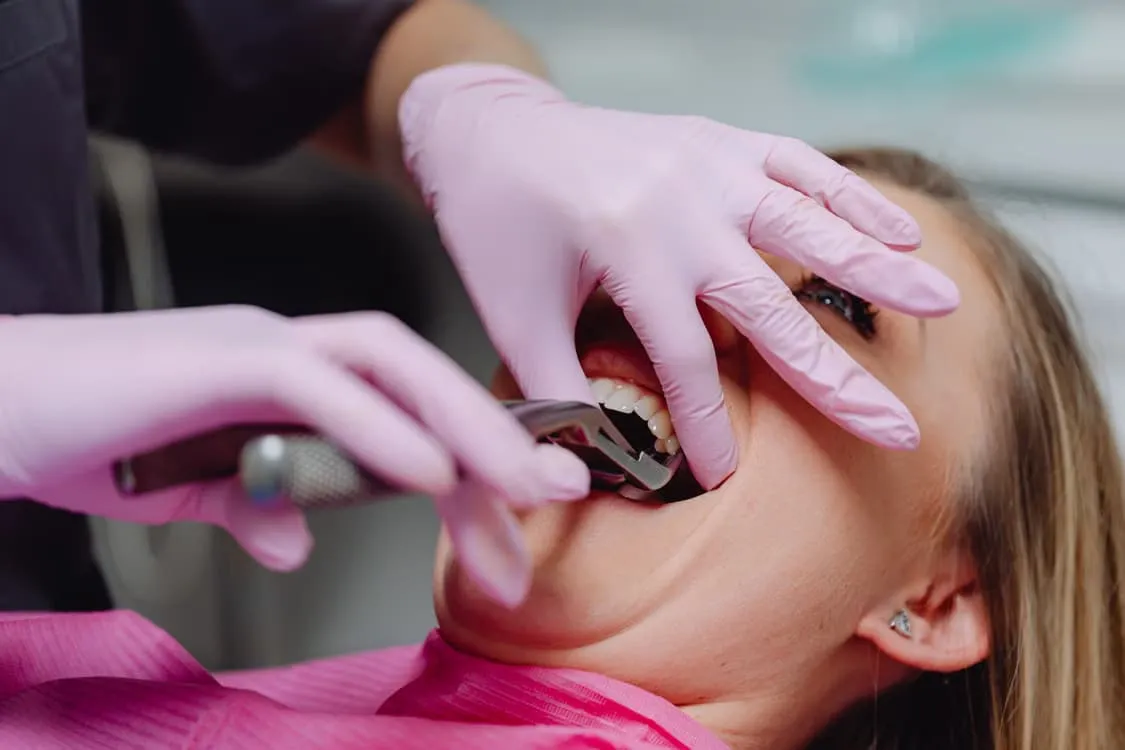 How to Prepare for Tooth Extractions Near Me