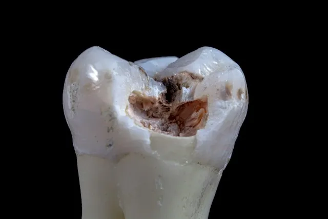 How Damaged Teeth Can Be Successfully Replaced