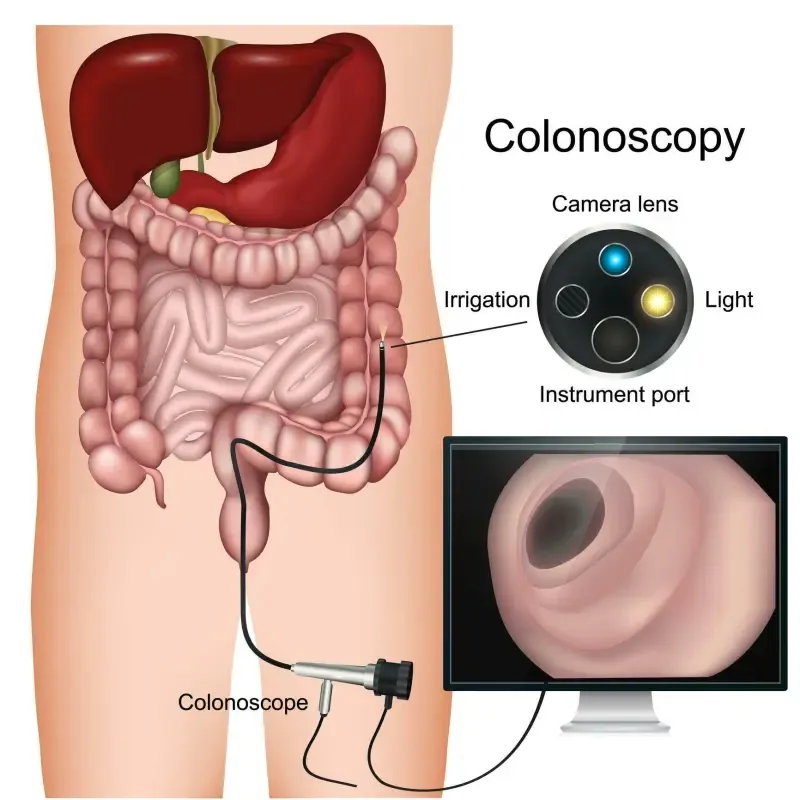 Best Colonoscopy Doctor in Ahmedabad: What to Know Before You Book