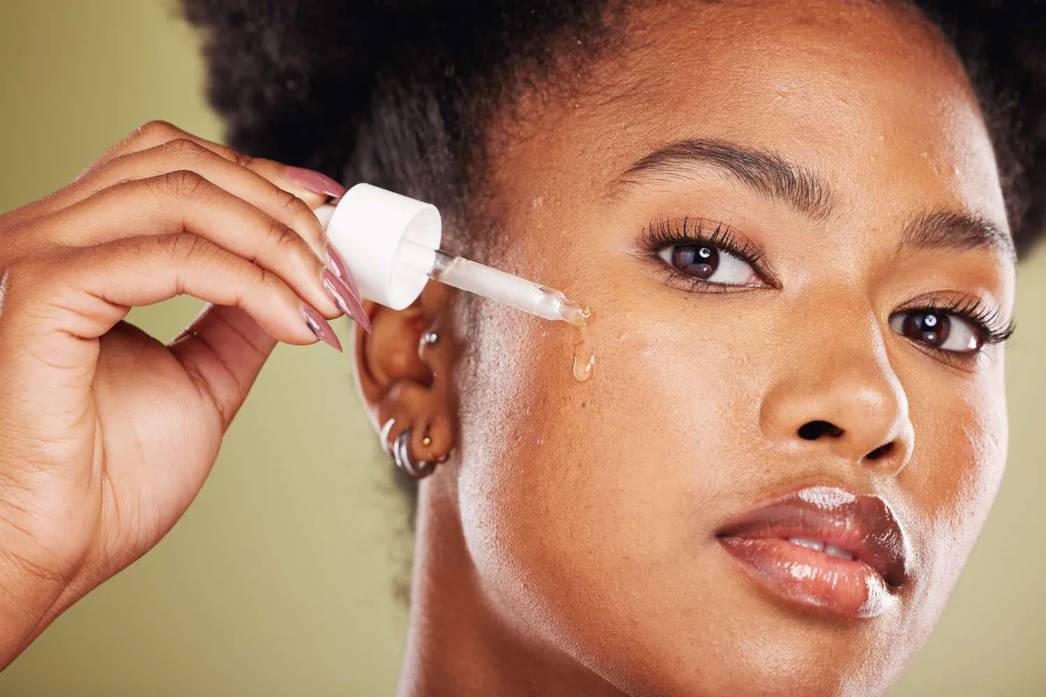 How to Treat Acne Marks and Pigmentation After Breakouts