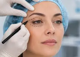 What Is the Best Time of Year for Eyelid Surgery in Islamabad?