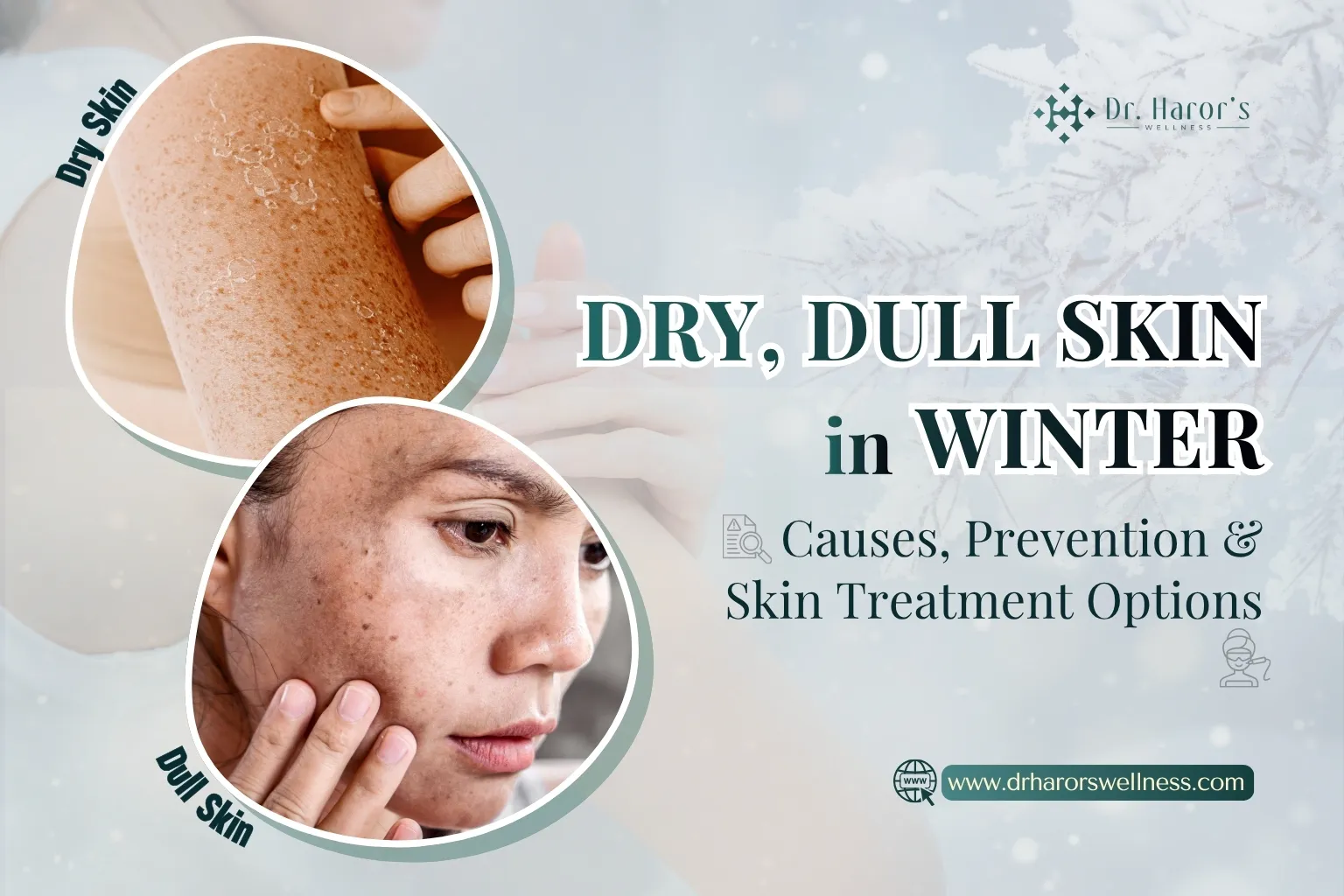 Dry, Dull Skin in Winter: Causes, Prevention & Skin Treatment Options