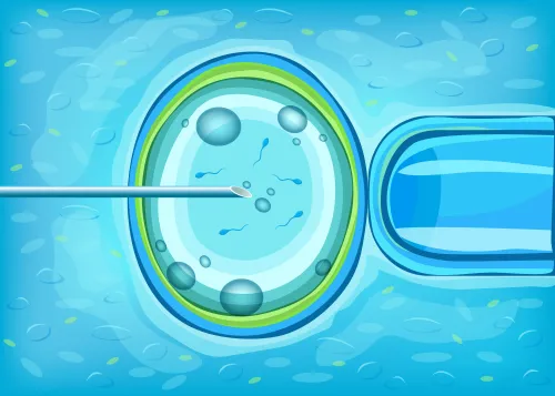 Frozen Embryo Transfer Treatment: Preparation, Procedure, and Recovery
