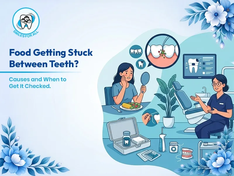 Food Keeps Getting Stuck Between Your Teeth? What You Should Know