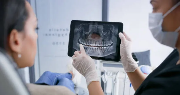 Gum Contouring Cost: Understanding Treatment Options and Benefits