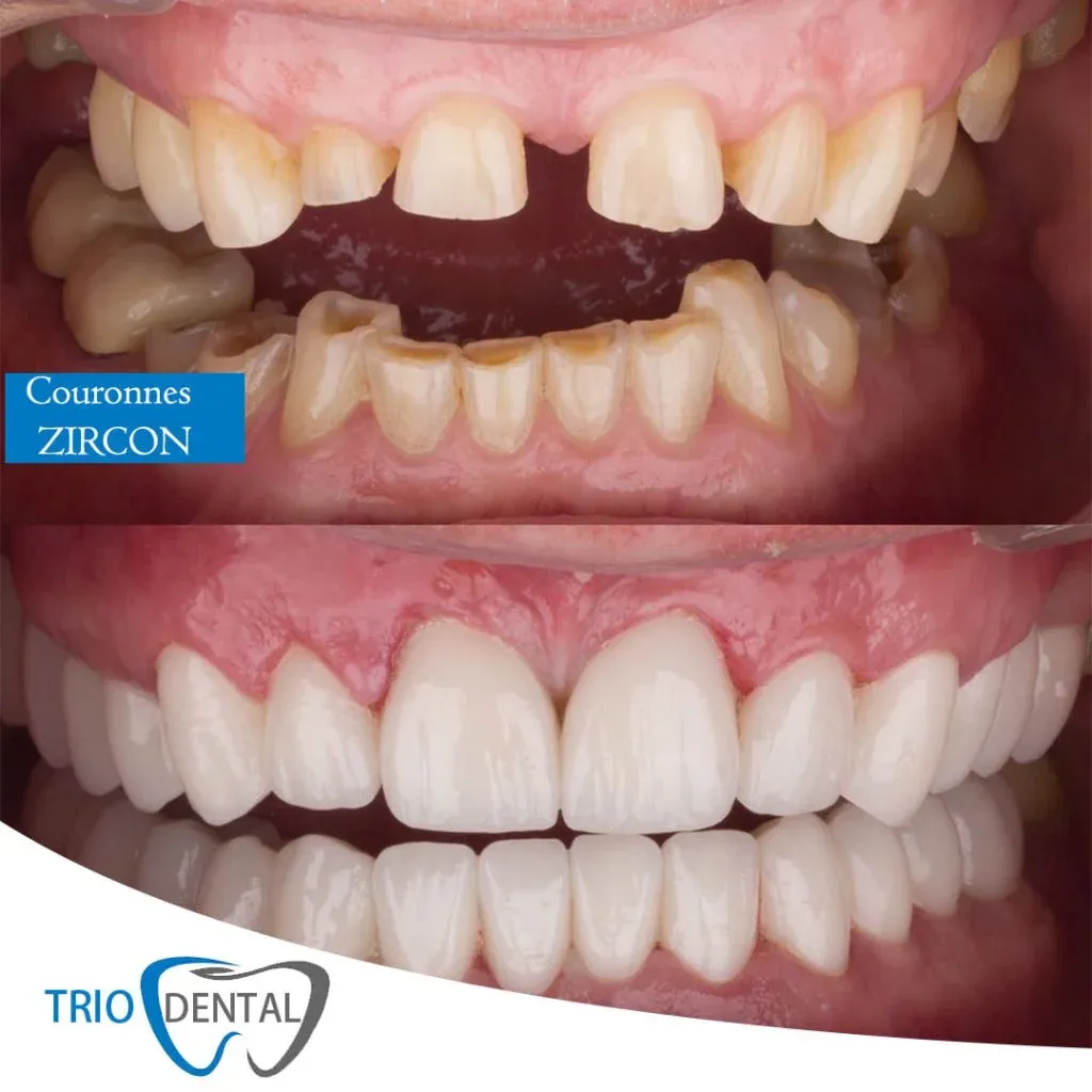 Modern Dental Innovations: Digital Precision in Smile Design