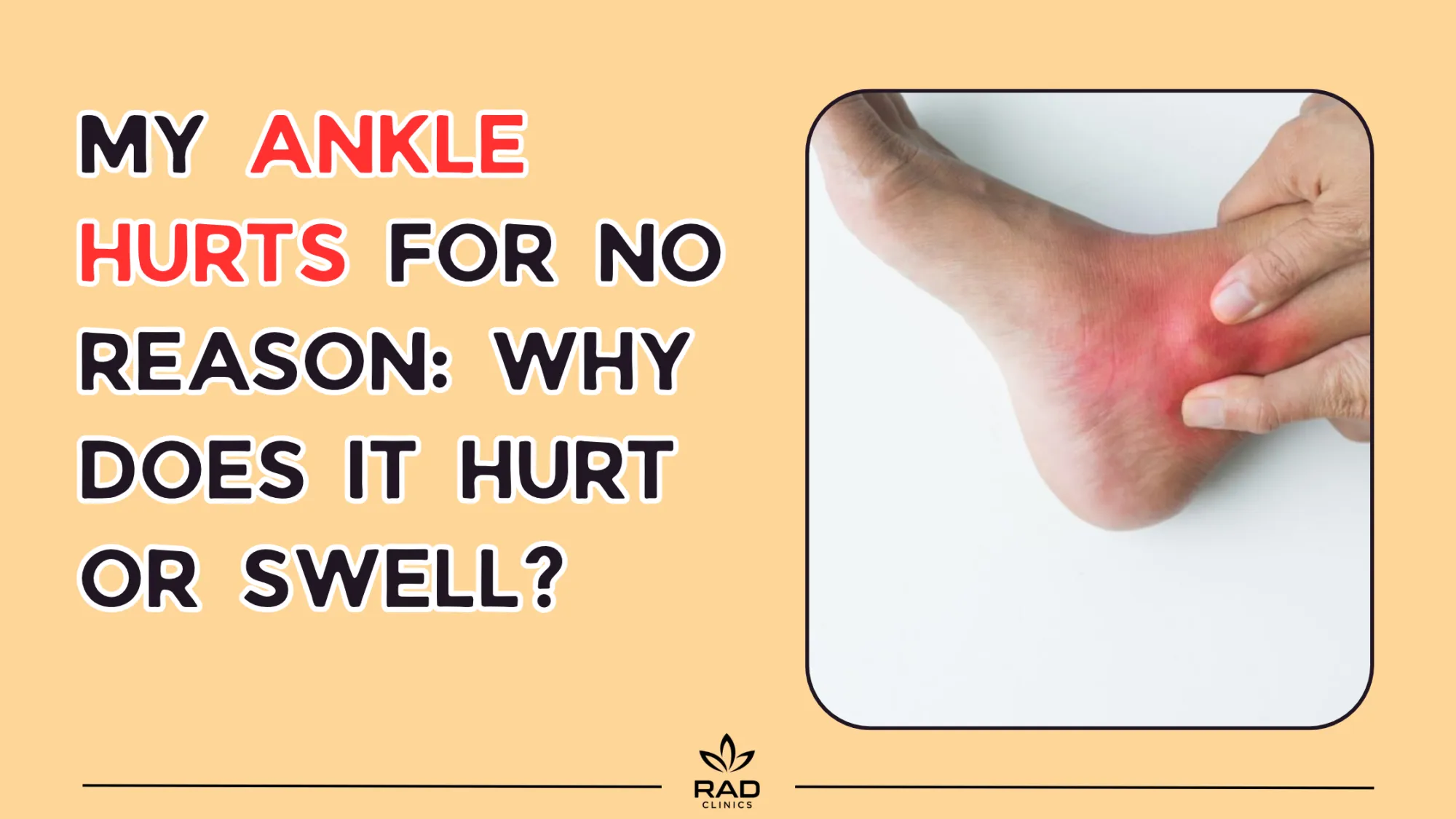 My Ankle Hurts for No Reason: Why Does It Hurt or Swell?