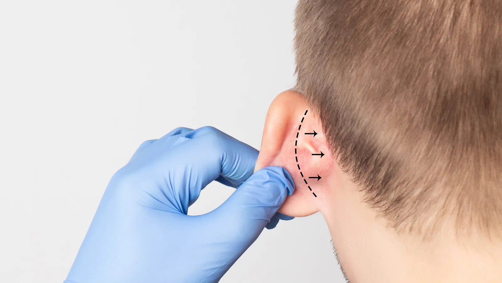 Ear Surgery for Children and Adults: What Indian Families Should Know