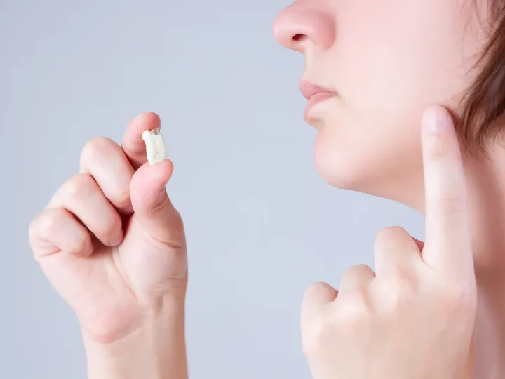 When Is Wisdom Teeth Removal Really Necessary?
