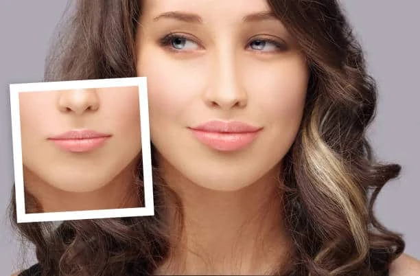 How Lip Enhancement NJ Can Improve Your Confidence