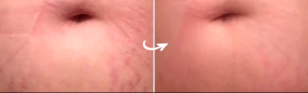 Things You Might Want To Know About Silicone Sheets